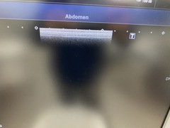 超音波診断装置（カラードプラ）｜Xario100 TUS-X100｜キヤノンメディカルシステムズの写真8枚目