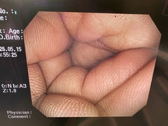 大腸ビデオスコープ｜CF-Q260AI｜オリンパスメディカルシステムズ株式会社の写真8枚目