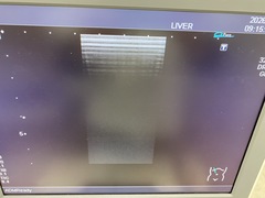 Ultrasound system(Color)｜SSA-590A  Nemio MX｜Canon Medical Systems photo6