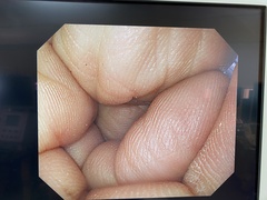 上部消化管汎用ビデオスコープ｜GIF-Q260｜オリンパスメディカルシステムズ株式会社の写真8枚目