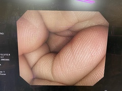 大腸ビデオスコープ｜CF-H260AI｜オリンパスメディカルシステムズ株式会社の写真8枚目