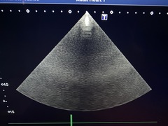 Ultrasound system(Color)｜Aplio 300｜Canon Medical Systems photo8