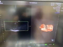 Ultrasound system｜Voluson Expert 22｜GE Healthcare photo8