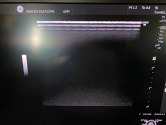 Ultrasound system(Color)｜LOGIQ S8 FS｜GE Healthcare photo5