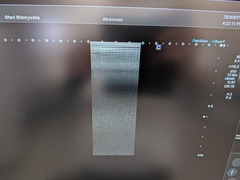 Ultrasound system(Color)｜Aplio go(CUS-AGG00)｜Canon Medical Systems photo8