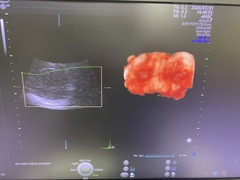 Ultrasound system(Color)｜Voluson E10｜GE Healthcare photo8