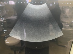 Ultrasound system｜Aplio 300 TUS−A300｜Canon Medical Systems photo8