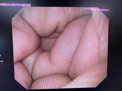 上部消化管汎用ビデオスコープ｜GIF-H260｜オリンパスメディカルシステムズ株式会社の写真8枚目