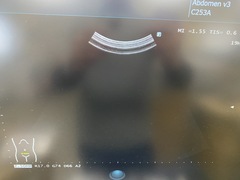 超音波診断装置｜ARIETTA 50｜富士フイルムメディカルの写真8枚目