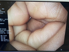 上部消化管用汎用ビデオスコープ｜GIF-XZ1200｜オリンパスメディカルシステムズ株式会社の写真8枚目