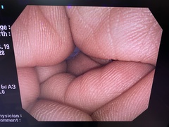 Video Colonoscope｜PCF-Q260AI｜Olympus Medical Systems photo8