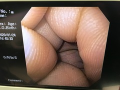 上部消化管汎用ビデオスコープ｜GIF-P140｜オリンパスメディカルシステムズ株式会社の写真9枚目