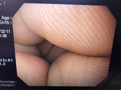 上部消化管汎用ビデオスコープ｜GIF-Q260｜オリンパスメディカルシステムズ株式会社の写真9枚目
