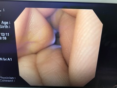 Video Gastroscope｜GIF-XQ200｜Olympus Medical Systems photo9