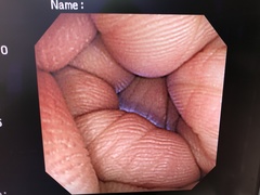 Video Colonoscope｜PCF-P240AI｜Olympus Medical Systems photo8