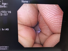 Video Gastroscope｜GIF-XQ240｜Olympus Medical Systems photo8