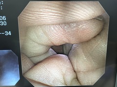 Video Gastroscope｜GIF-XP260｜Olympus Medical Systems photo8