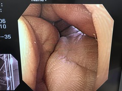 Video Gastroscope｜GIF-SV｜Olympus Medical Systems photo9
