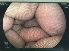 Video Colonoscope｜EC-590ZW/M｜Fujifilm Medical photo9