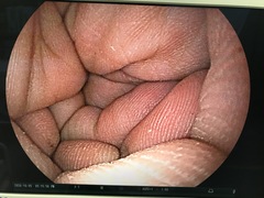 Video Transnasal Gastroscope｜EG-580NW｜Fujifilm Medical photo9