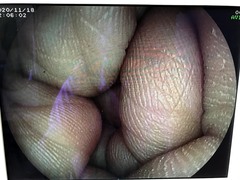 Video Gastroscope｜EG-3000FP｜Fujifilm Medical photo8