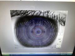 Corneal Topographer｜CT-1000｜Rexxam Co.,Ltd photo6