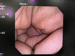 Video Transnasal Gastroscope｜GIF-XP260N｜Olympus Medical Systems photo9
