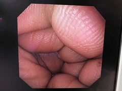 上部消化管汎用ビデオスコープ｜GIF-XP290N｜オリンパスメディカルシステムズ株式会社の写真9枚目