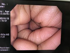 Video Colonoscope｜CF-Q260AI｜Olympus Medical Systems photo9