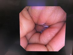 大腸ビデオスコープ｜PCF-240I｜オリンパスメディカルシステムズ株式会社の写真9枚目