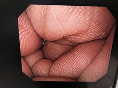 上部消化管汎用ビデオスコープ｜GIF-Q260｜オリンパスメディカルシステムズ株式会社の写真9枚目