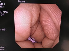 Video Gastroscope｜GIF-XP260NS｜Olympus Medical Systems photo9