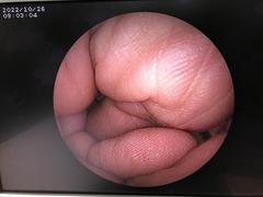 Video Transnasal Gastroscope｜EG-3000N｜Fujifilm Medical photo9