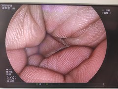 Video Gastroscope｜EG-550WR｜Fujifilm Medical photo9