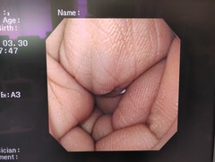 Video Gastroscope｜GIF-XQ240｜Olympus Medical Systems photo9