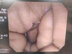 上部消化管汎用ビデオスコープ｜GIF-Q260J｜オリンパスメディカルシステムズ株式会社の写真9枚目