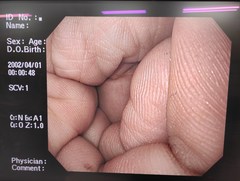 上部消化管汎用ビデオスコープ｜GIF-H260｜オリンパスメディカルシステムズ株式会社の写真9枚目