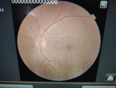 Non-Mydriatic Retinal Camera｜TRC-NW400｜Topcon photo9