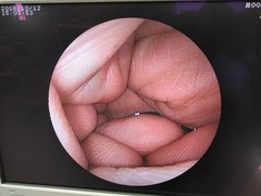 Video Transnasal Gastroscope｜EG-530N｜Fujifilm Medical photo9