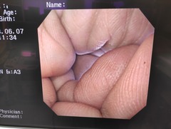上部消化管汎用ビデオスコープ｜GIF-XQ260｜オリンパスメディカルシステムズ株式会社の写真9枚目