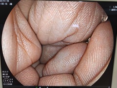 上部消化管用経鼻スコープ｜EG-L580NW｜富士フイルムメディカルの写真9枚目
