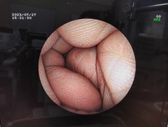 Video Transnasal Gastroscope｜EG-270N5｜Fujifilm Medical photo9