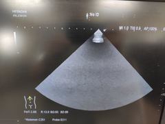 Ultrasound system｜ARIETTA 60｜Hitachi photo9