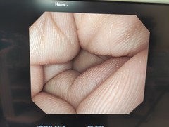 上部消化管汎用ビデオスコープ｜GIF-Q260｜オリンパスメディカルシステムズ株式会社の写真9枚目