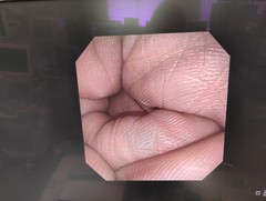上部消化管汎用ビデオスコープ(径鼻)｜GIF-XP150N｜オリンパスメディカルシステムズ株式会社の写真9枚目