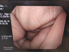 Video Gastroscope｜GIF-PQ260｜Olympus Medical Systems photo9