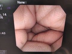大腸ビデオスコープ｜CF-240I｜オリンパスメディカルシステムズ株式会社の写真9枚目