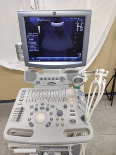超音波診断装置（カラードプラ）｜LOGIQ P5｜GEヘルスケアの写真9枚目
