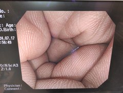 大腸ビデオスコープ｜CF-Q260AI｜オリンパスメディカルシステムズ株式会社の写真9枚目