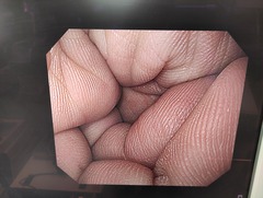 上部消化管汎用ビデオスコープ｜GIF-H260｜オリンパスメディカルシステムズ株式会社の写真9枚目